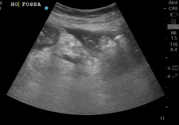 EEU case image missing